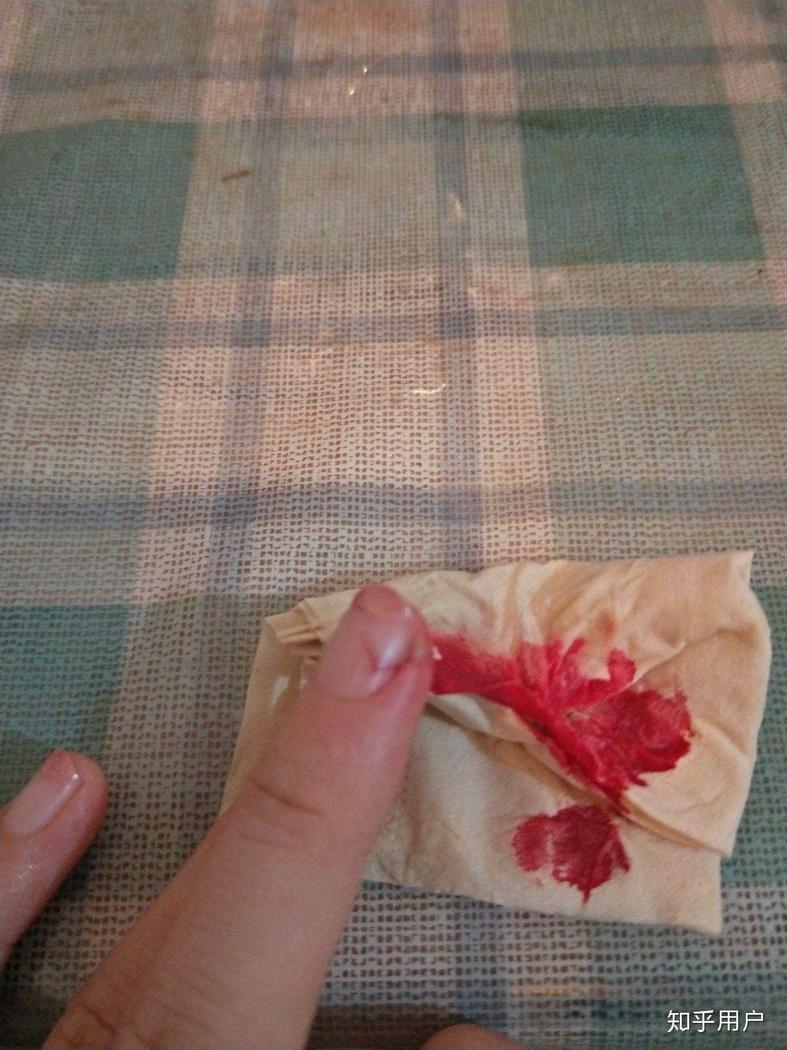 切菜时切到手是一种什么样的体验? - 知乎