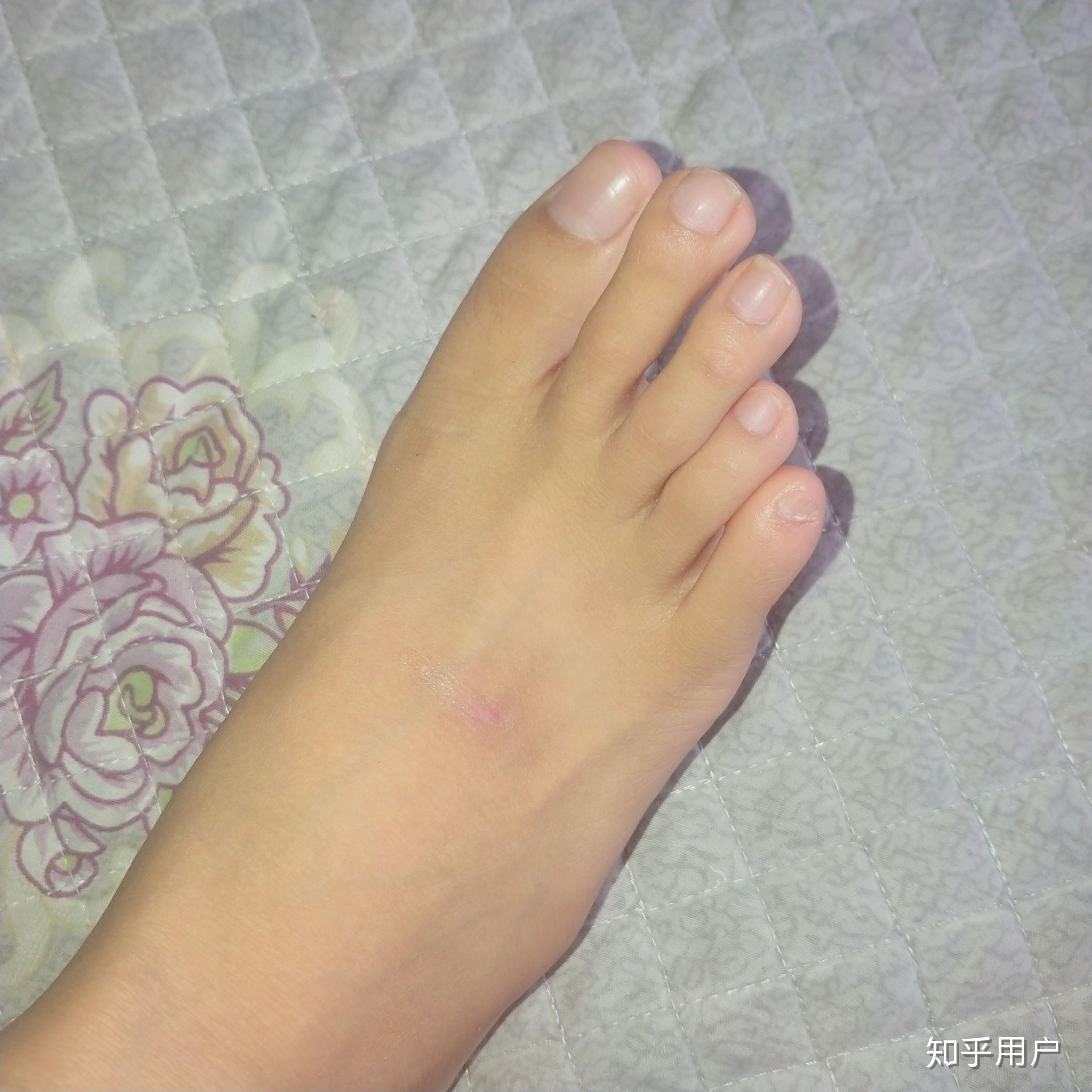 女生有一双很丑的脚有什么体验? - 知乎