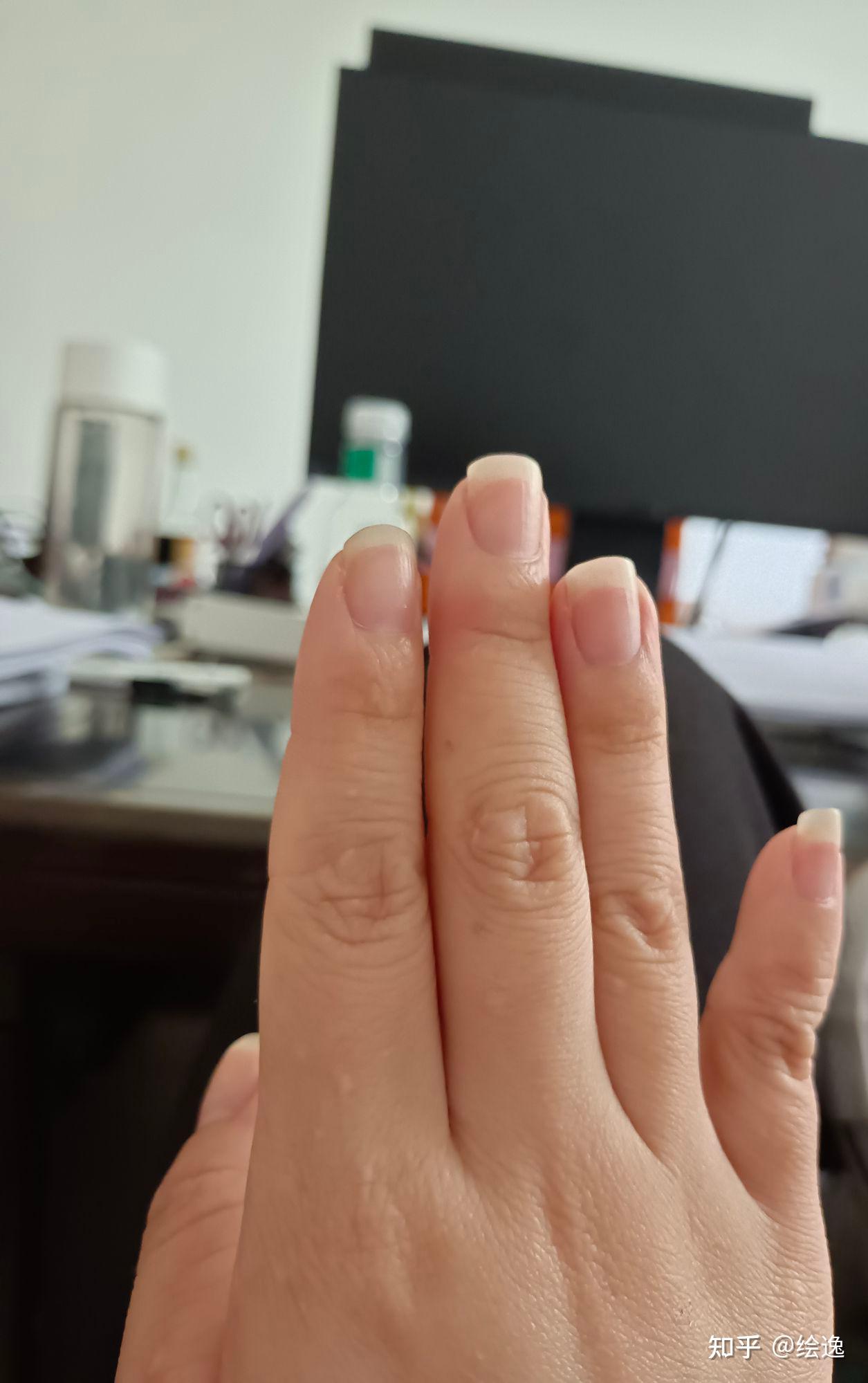 中指因为写字变形,有什么方法? - 知乎