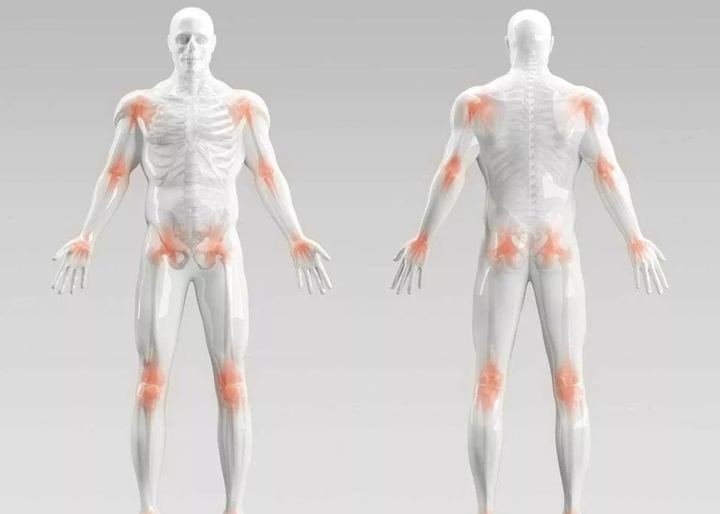 步态分析与关节活动度评定 - 知乎