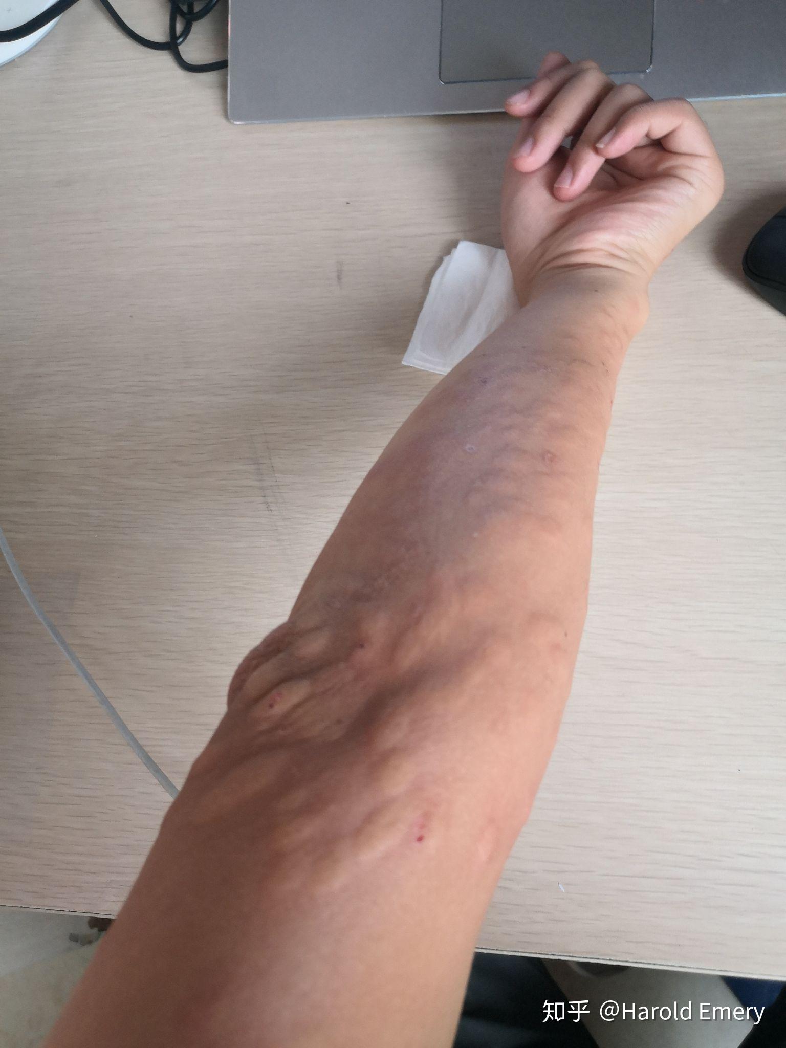 四川很小的一种蚊子蠛蚊是什么东西