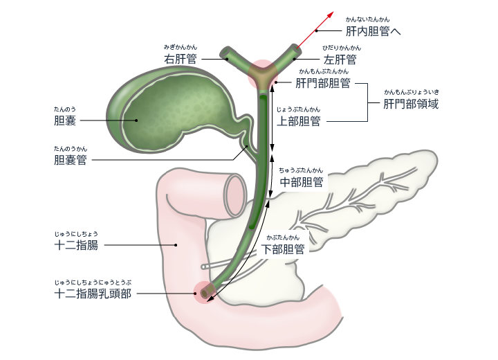 什么是胆管扩张，该怎么治疗？ 知乎