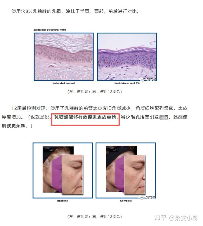 男士护肤品_油皮控油水乳推荐_男士水乳选择指南