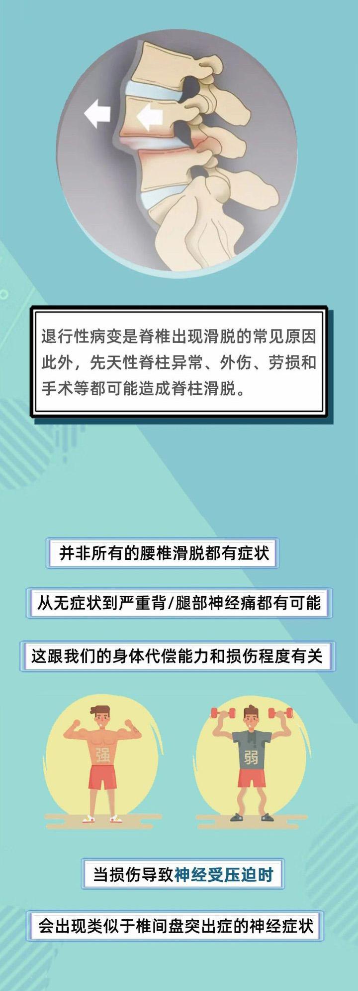 腰椎滑脱保守治疗图解图片