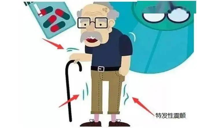 原发性震颤、抽动秽语综合征、迟发性运动障碍 - 知乎