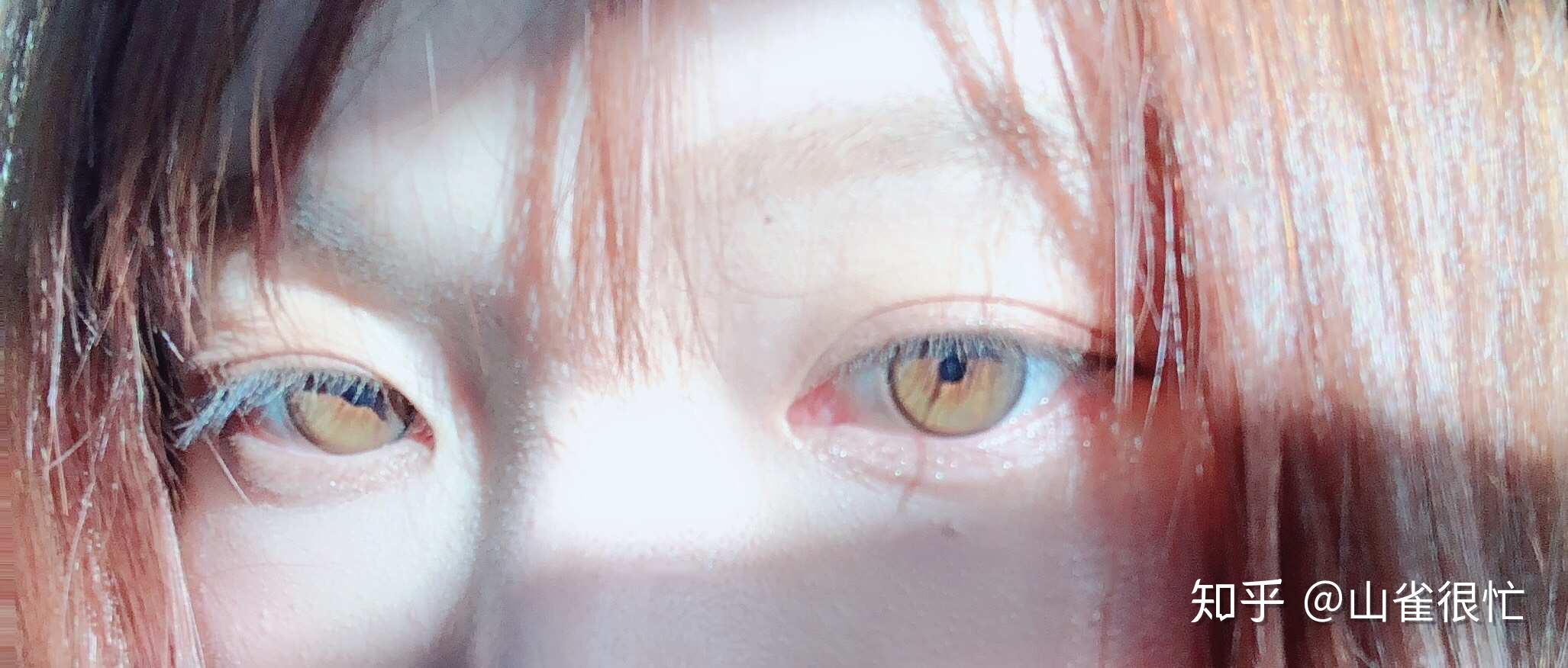 有和我一样天生绿眼睛的中国人么