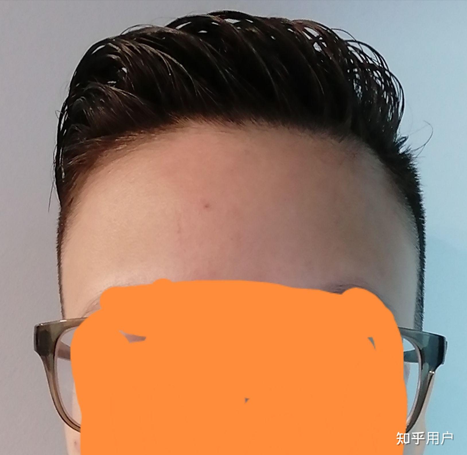 额头宽长是什么体验? - 知乎