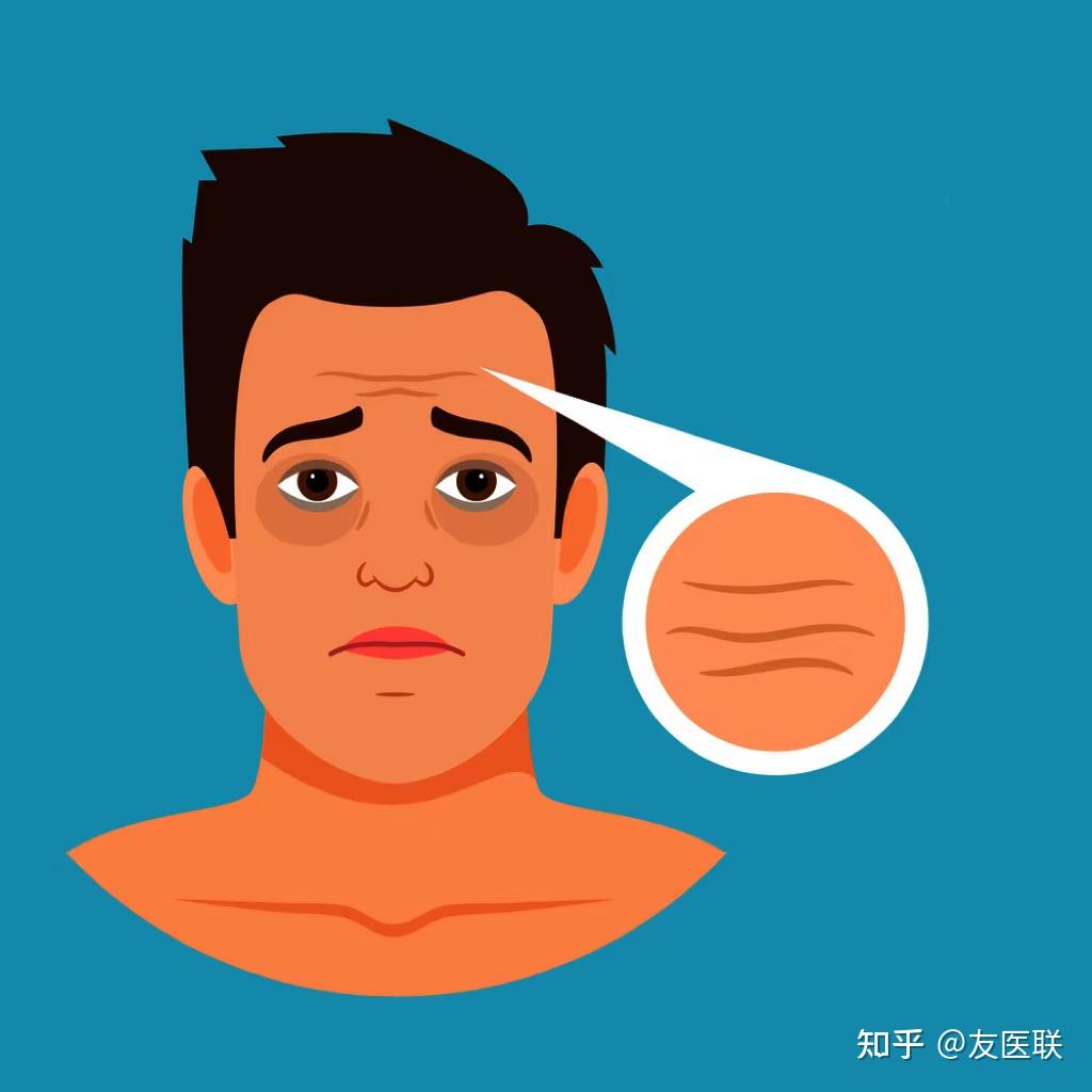 18岁额头上有两道静态抬头纹,无论什么表情都有,怎么去掉? - 知乎