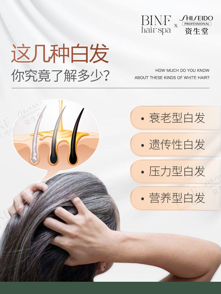 这几种白发你究竟了解多少? - 知乎