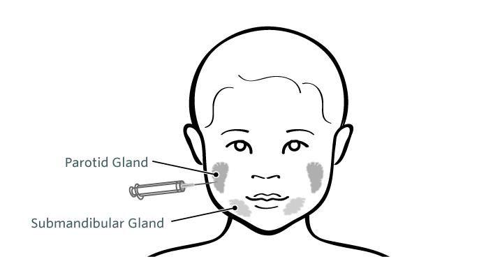 腮帮子两侧长痘痘反反复复怎么办