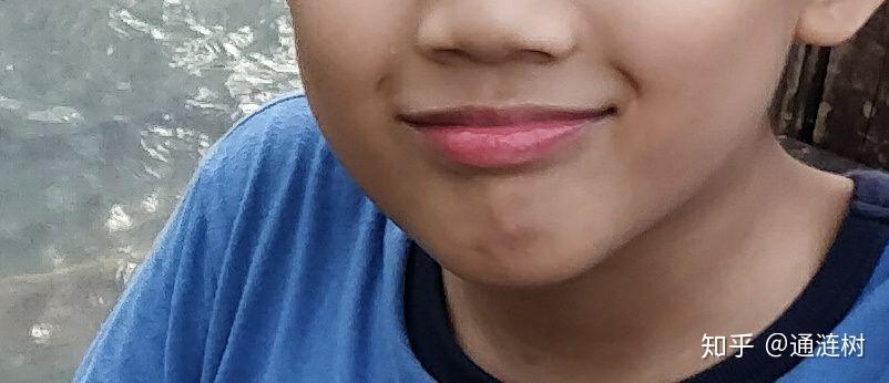 有人知道笑起来嘴角上面的小括号是什么吗不像梨涡酒窝