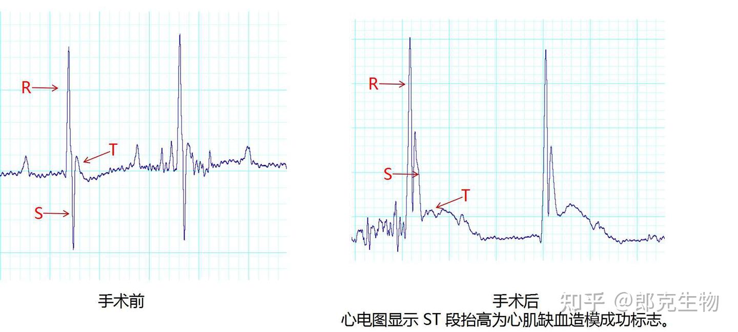 缺血性心衰模型（慢性心衰&急性心衰）-动物造模 - 知乎