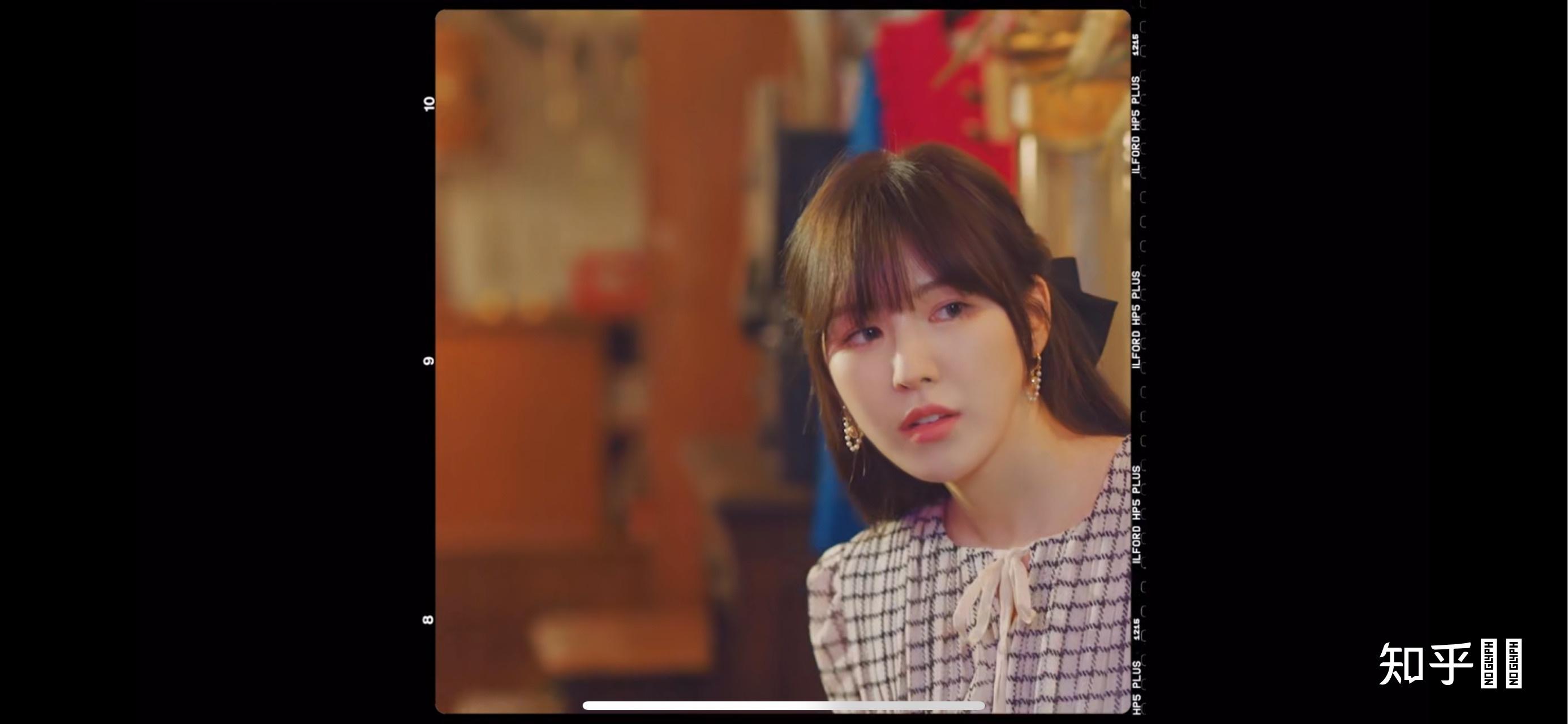 redvelvet的孙胜完wendy受伤后面部是否和以前不同