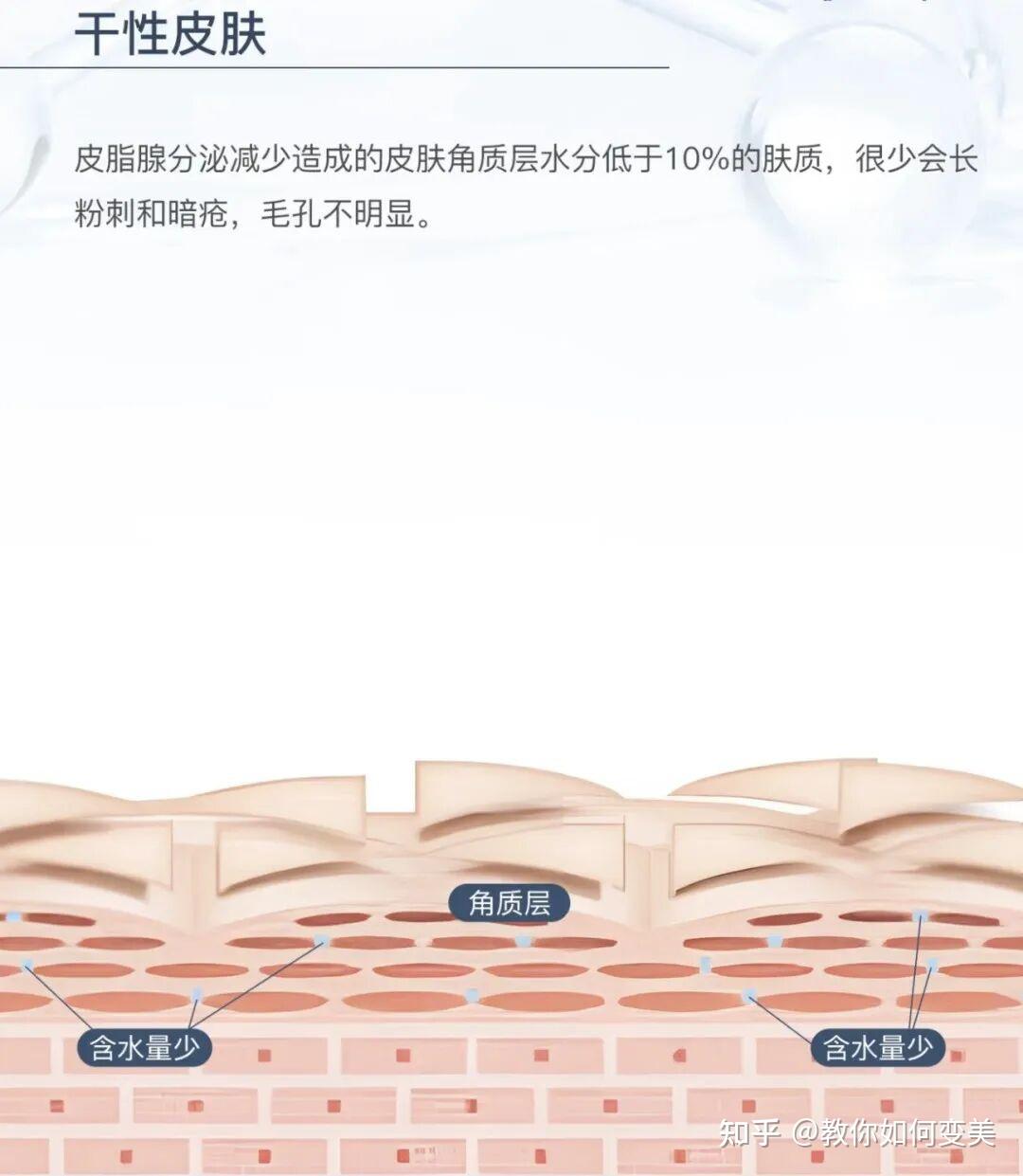 什么是干性皮肤，干性皮肤怎么护肤？ - 知乎