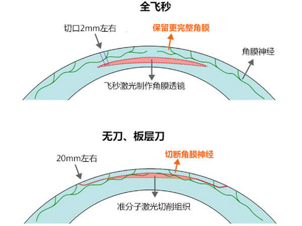 全飞秒和半飞秒哪个更好