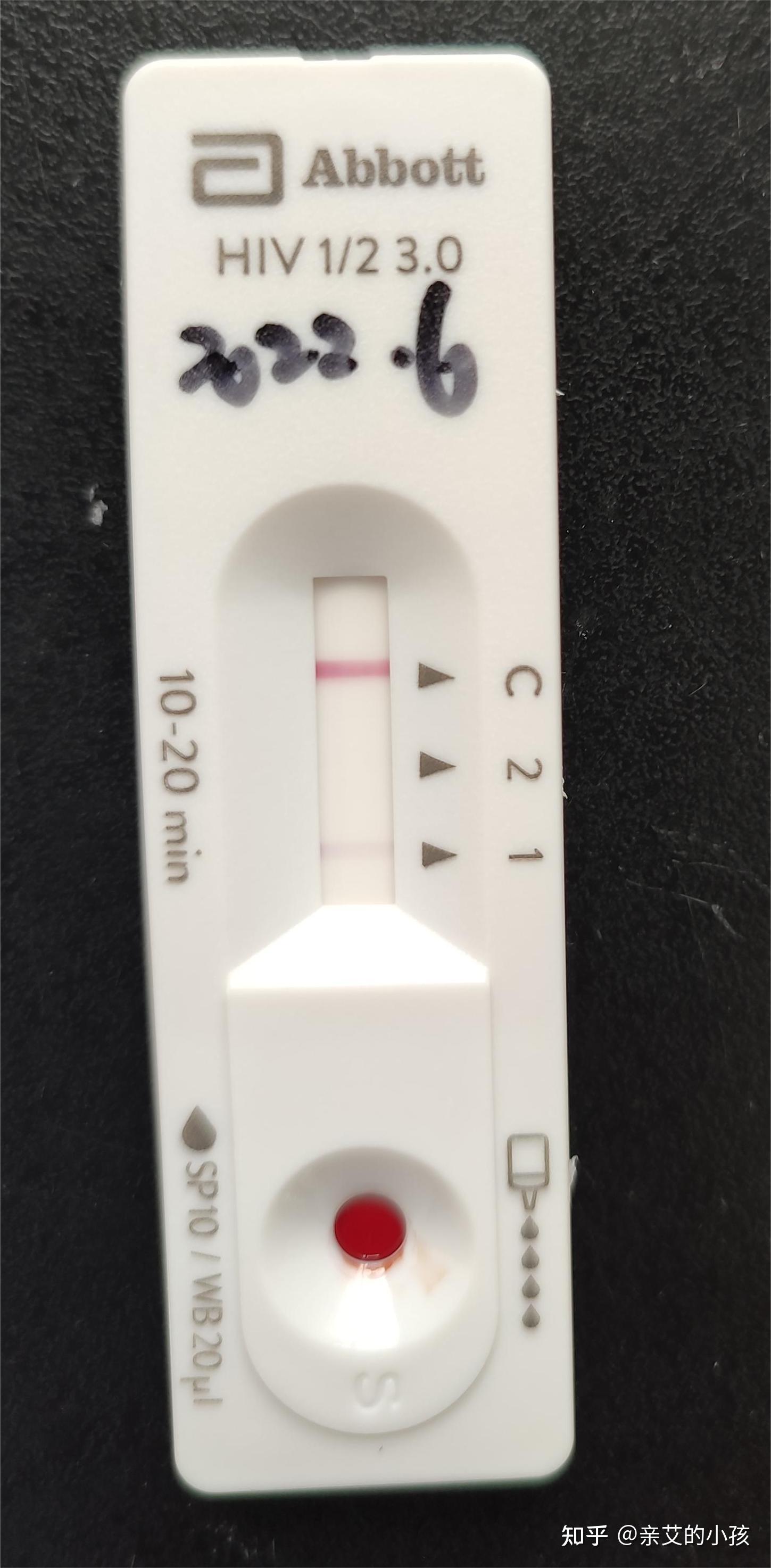 hiv试纸变换角度看到会看到t区附近有线是包埋线吗?