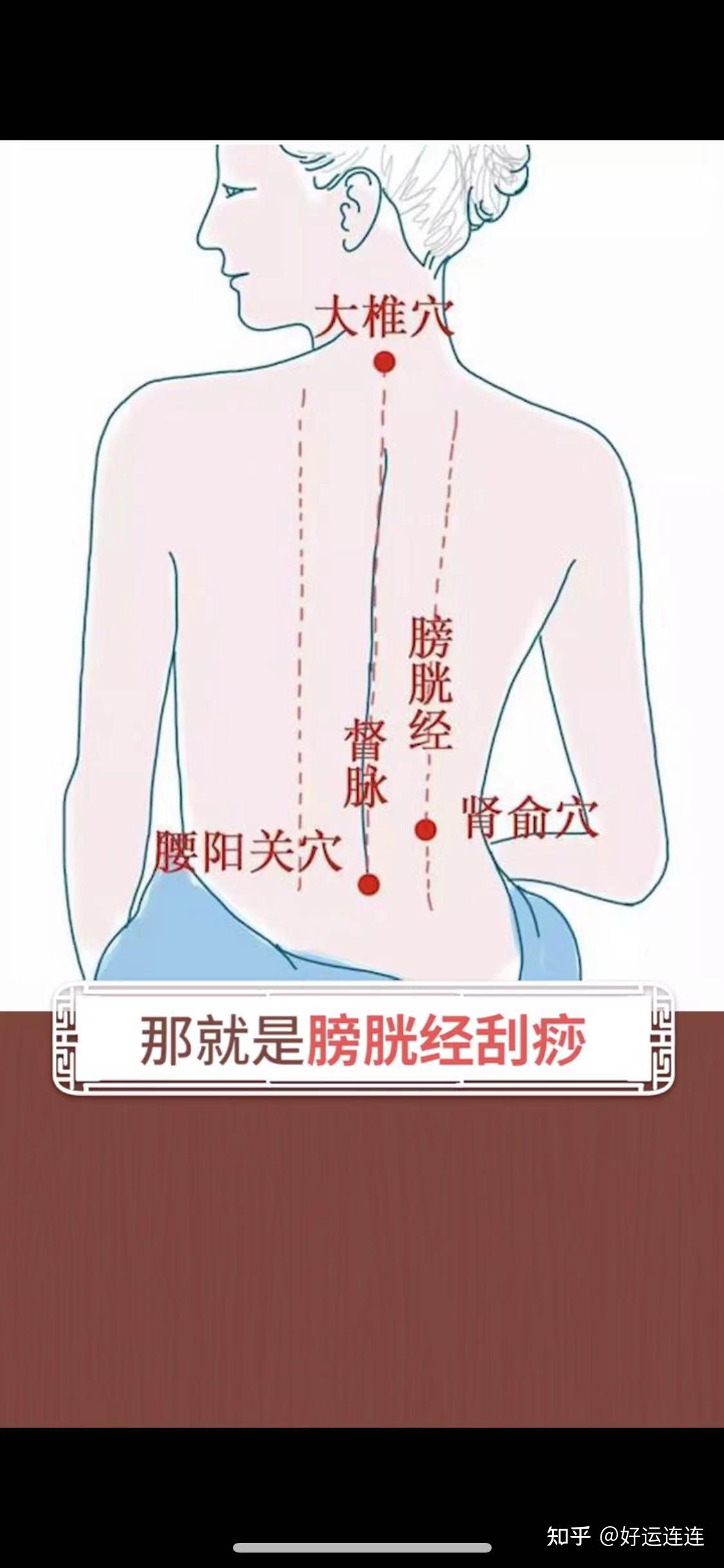 过敏性鼻炎刮痧刮图解图片