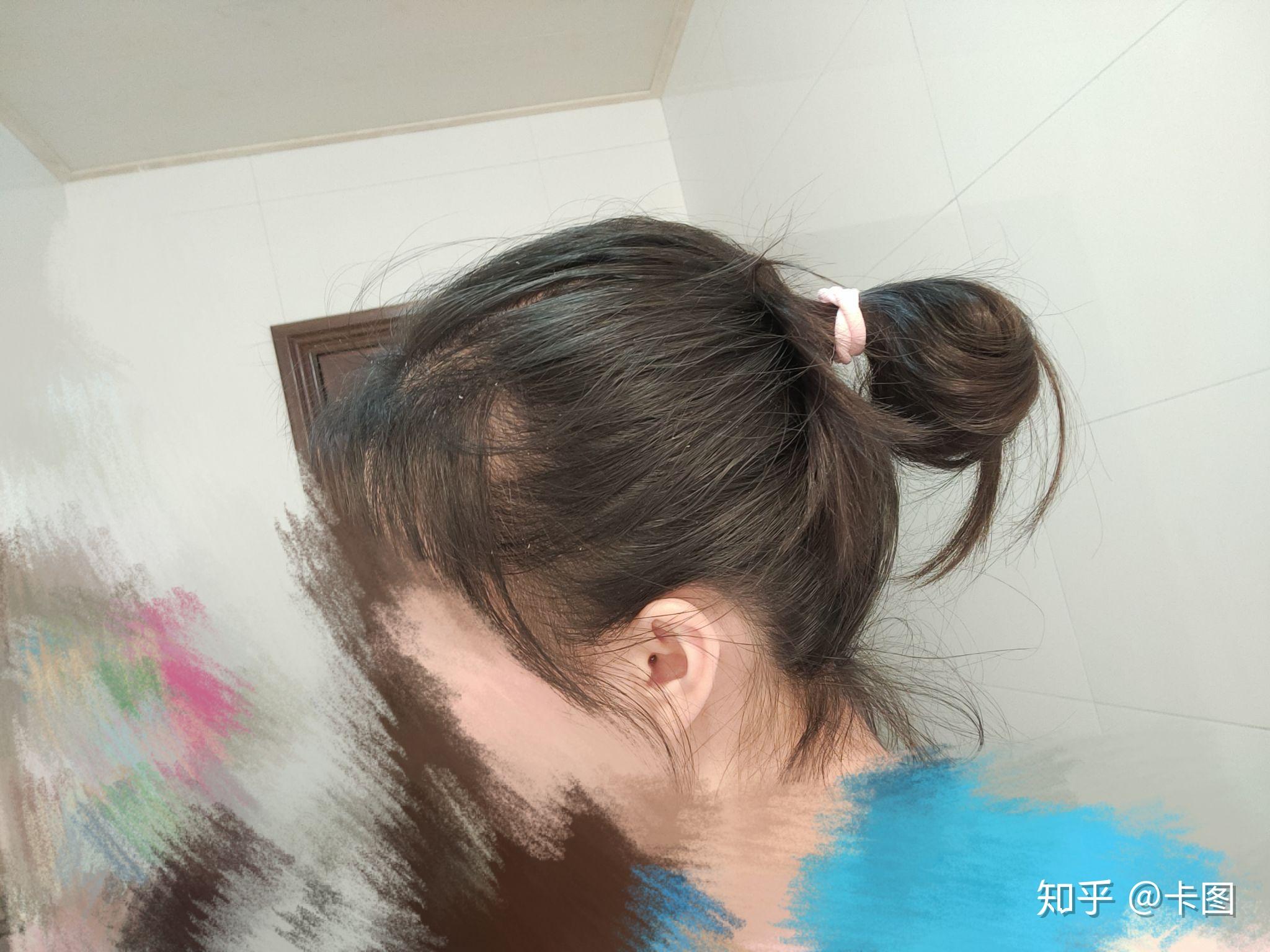 女生头顶头发少是什么体验