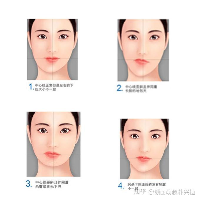 怎么改善大小脸左边脸小右边脸大而且左边的眼睛高于右边的眼睛