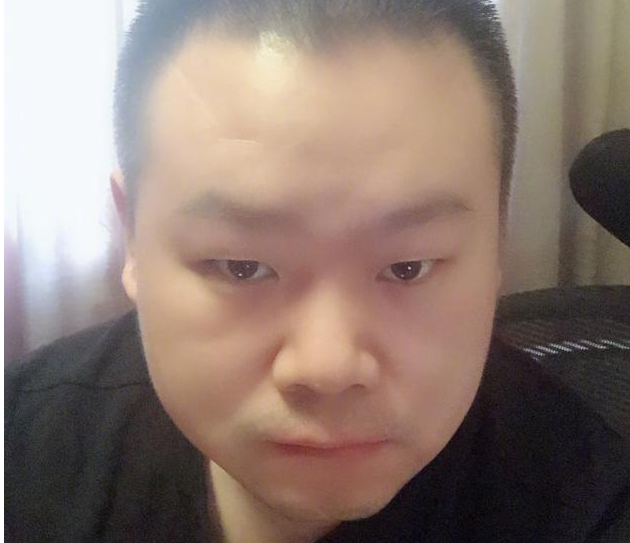 岳云鹏开始掉头发? 网友表示:秃如其来!