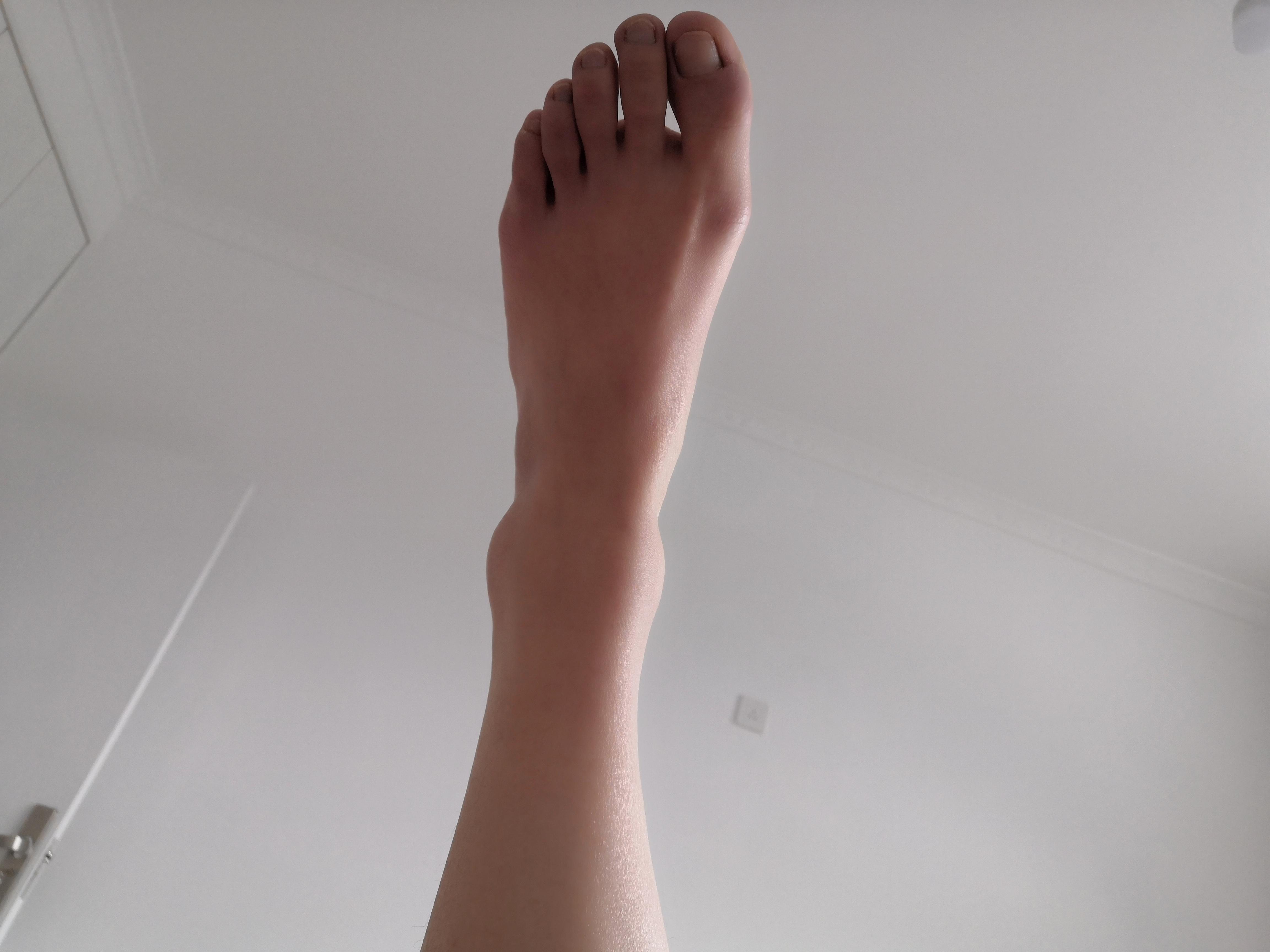 脚踝骨粗2425厘米的女生是不是真的瘦不了腿了