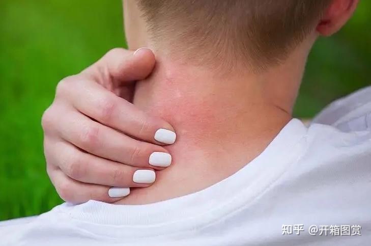 怎么能看出来床上有没有螨虫?家里有必要用除螨仪吗?除螨相关知识科普,附三大选购技巧