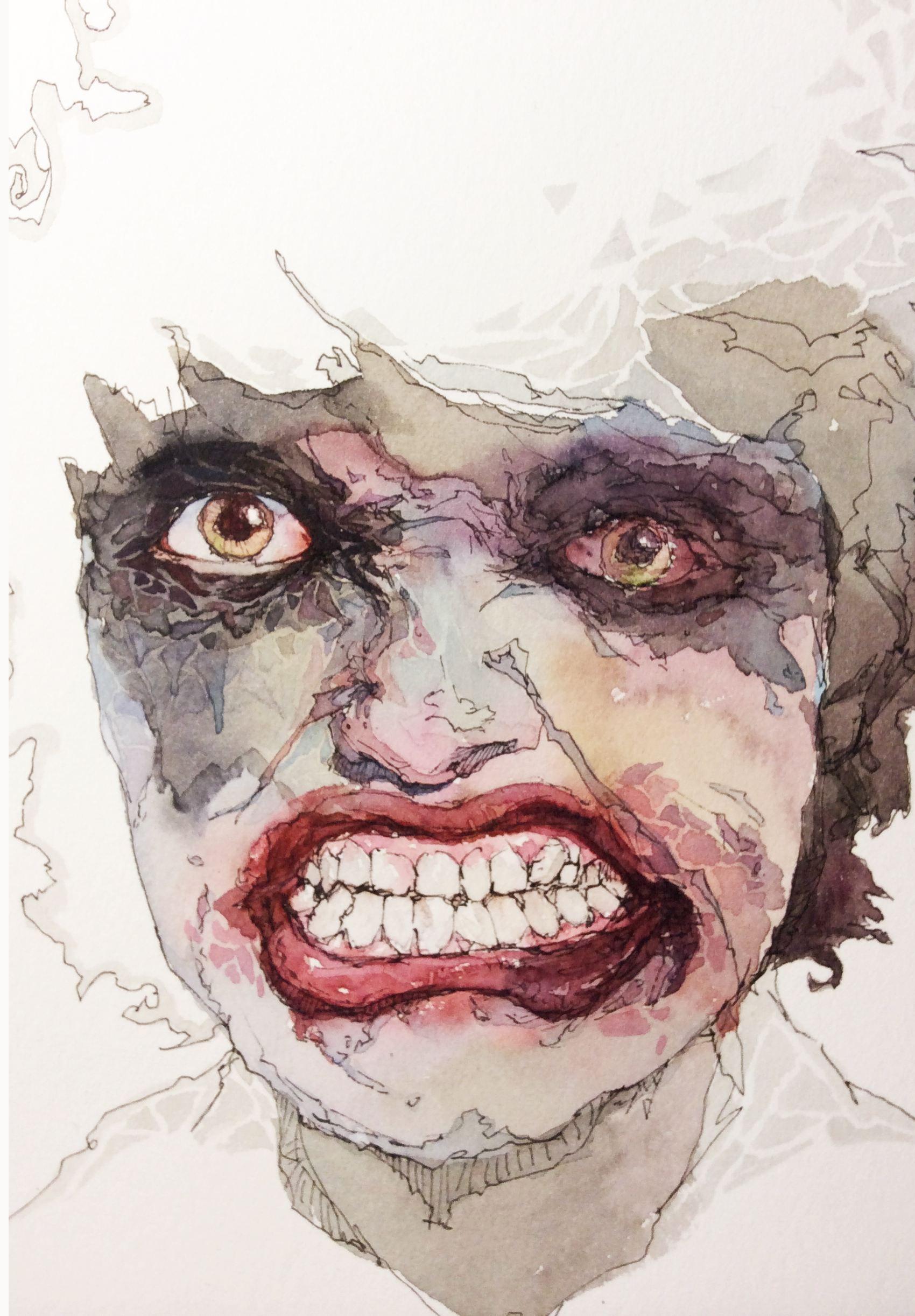 癔症歇斯底里的类别