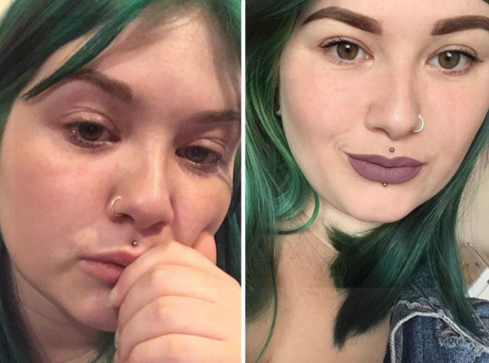 得了抑郁症的人眼神是不是都是一样的