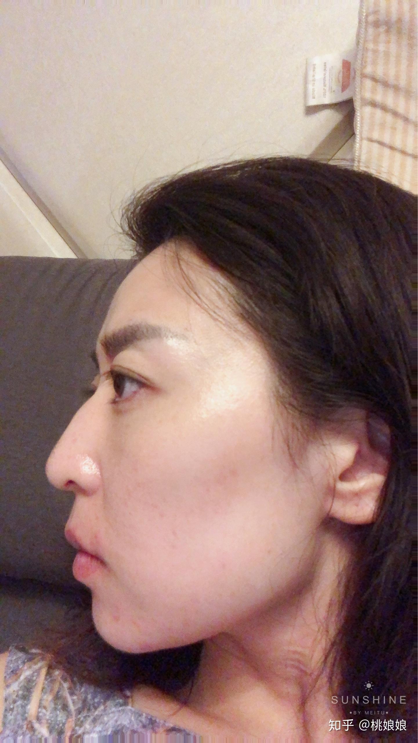 眼睛比山根突出怎么办? - 知乎