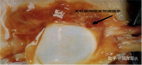 猪丹毒病变报告 - 知乎