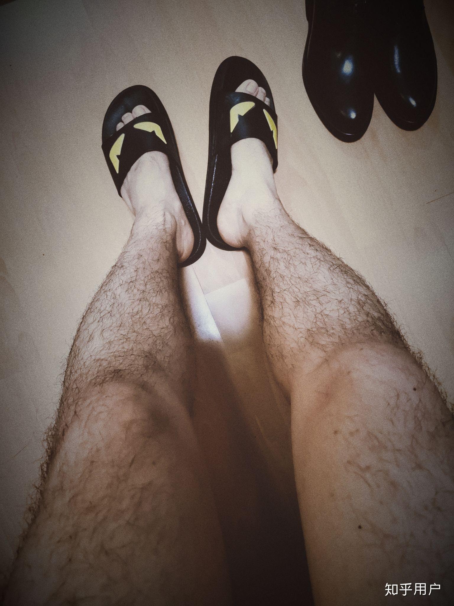 腿毛多的男生夏天怎么办