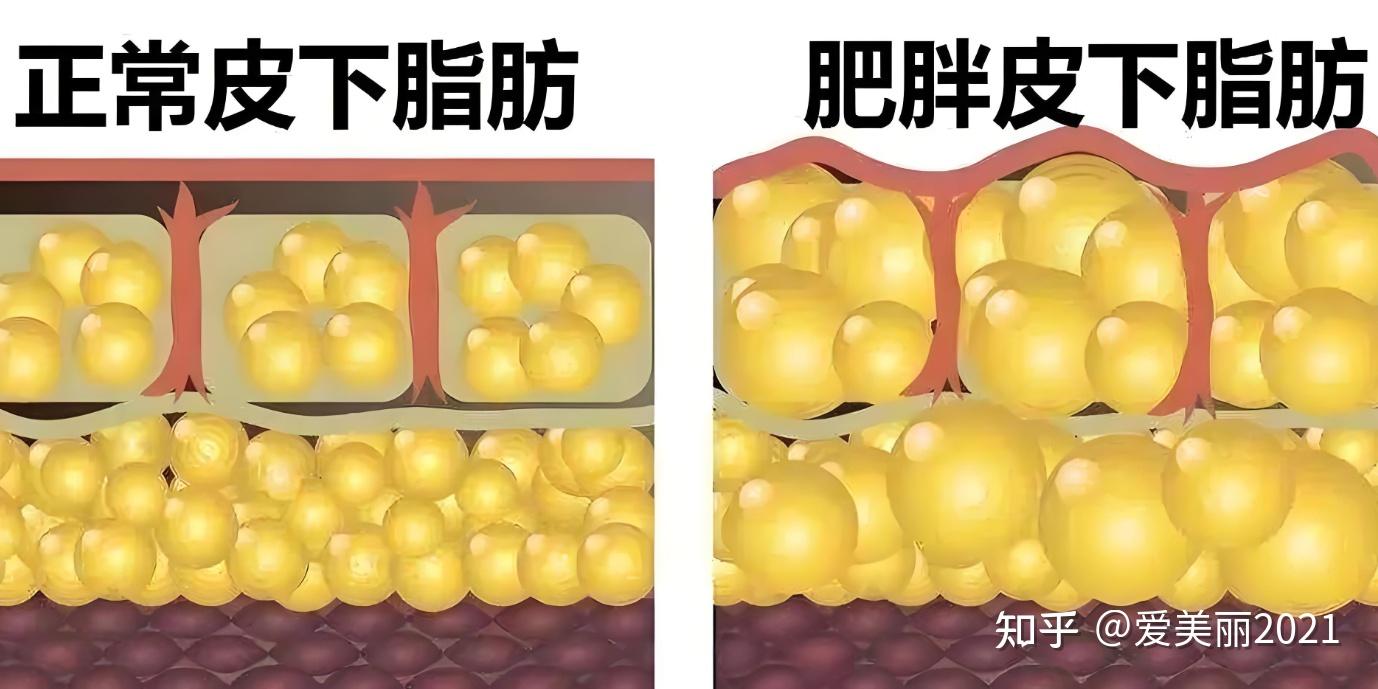 皮下脂肪有哪些作用? - 知乎