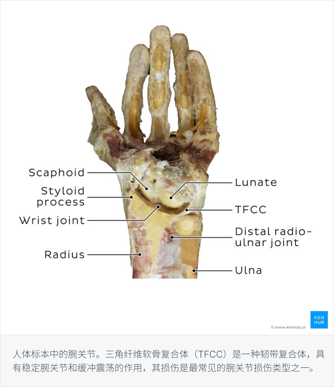 手部解剖:骨骼、肌肉、动脉与神经 - 知乎