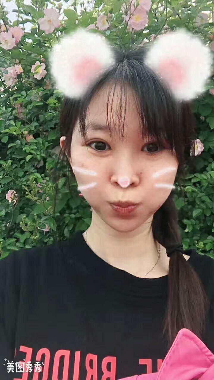 上海九院朱慧敏开眼角和双眼皮怎么样