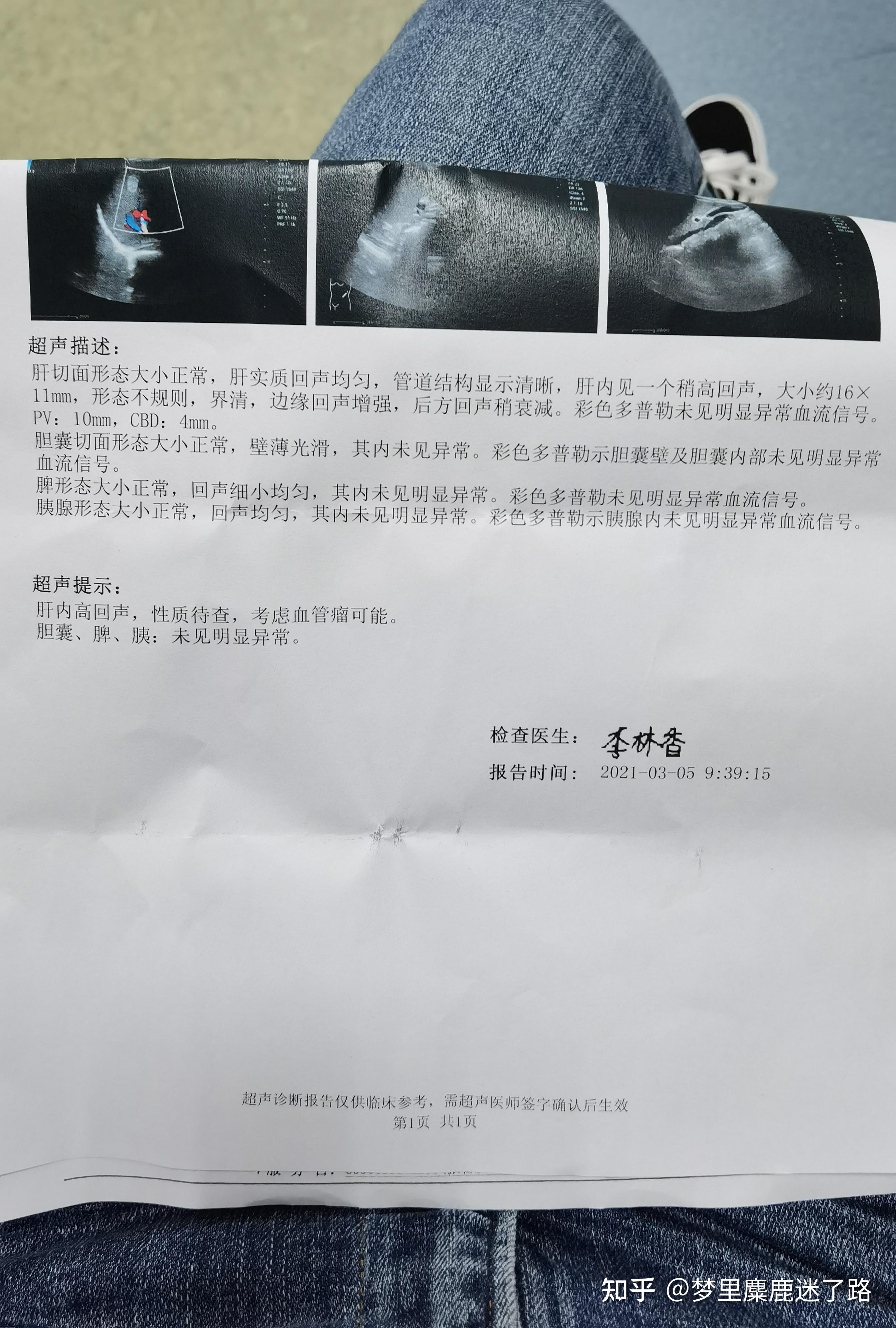 体检检查出来肝血管瘤怎么办,还没有小孩呢现在? - 知乎