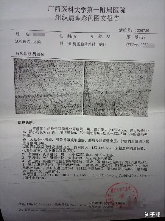有没有胃癌中晚期活过10年的积极例子