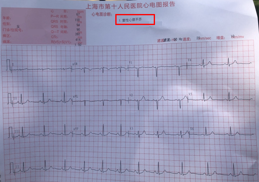 朋友体检发现是窦性心律不齐,她好慌啊?我需要怎么样安慰她呢? - 知乎