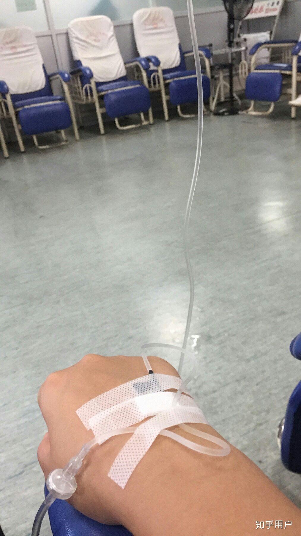 有没有输液的照片我给老师请的病假她要我发照片给她