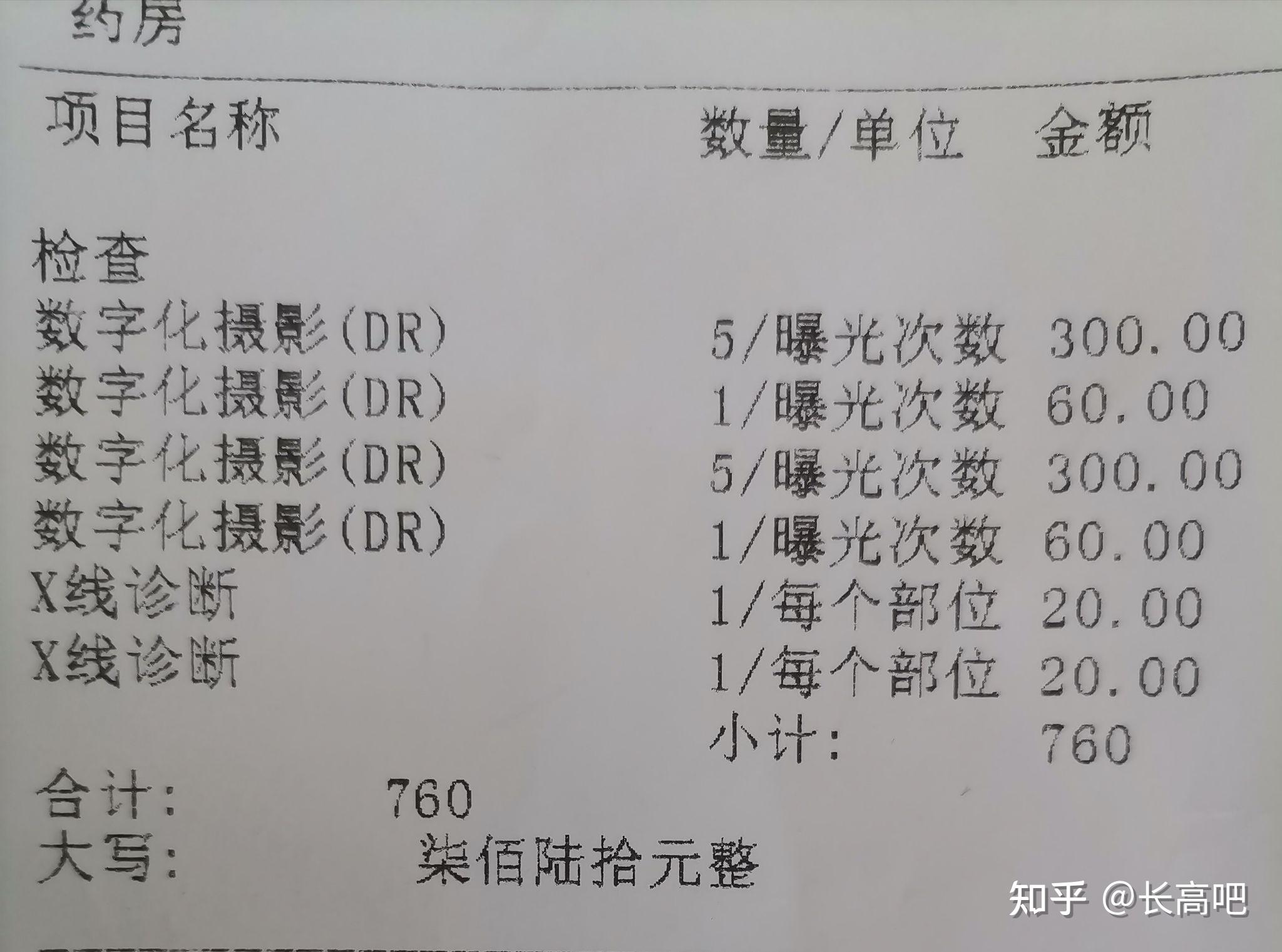 拍全脊柱正侧位x光片多少钱?