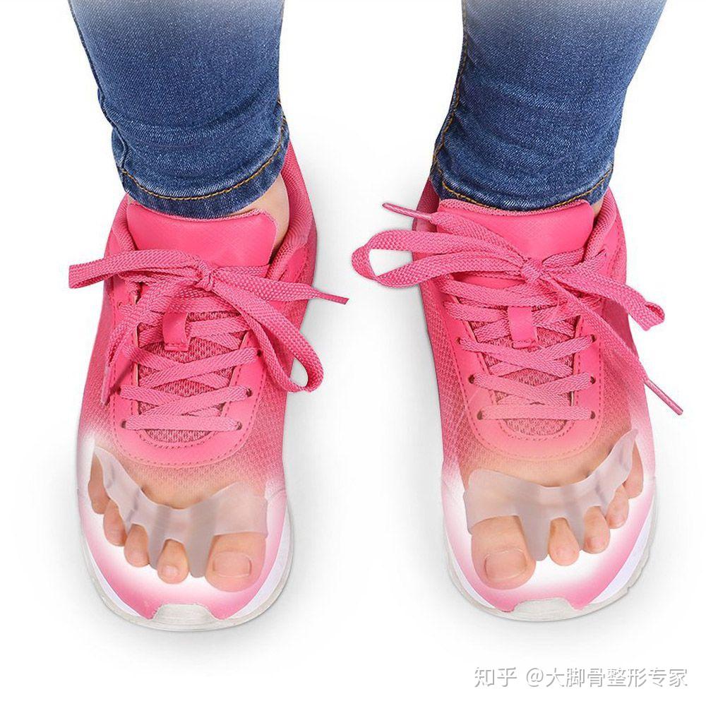 大脚趾外翻的鞋子有哪些适合的