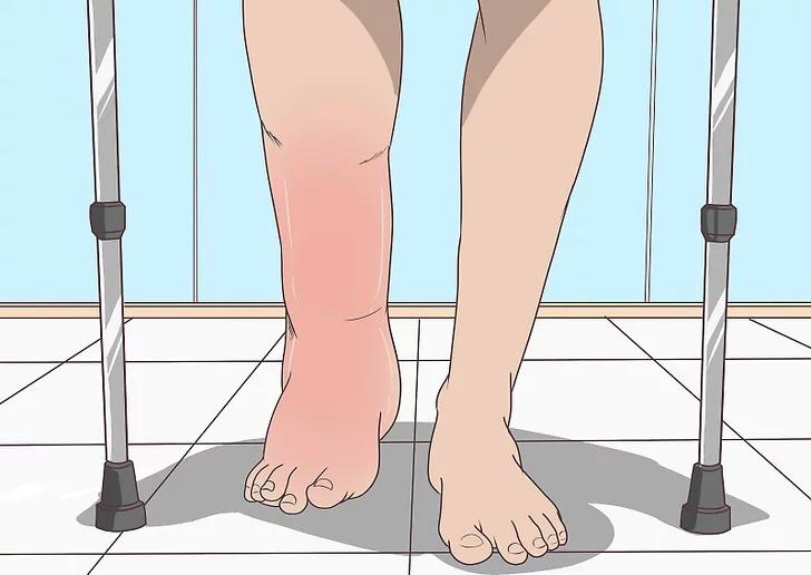 从腿部看出身体疾病?经常有这10种情况的人危险了 - 知乎