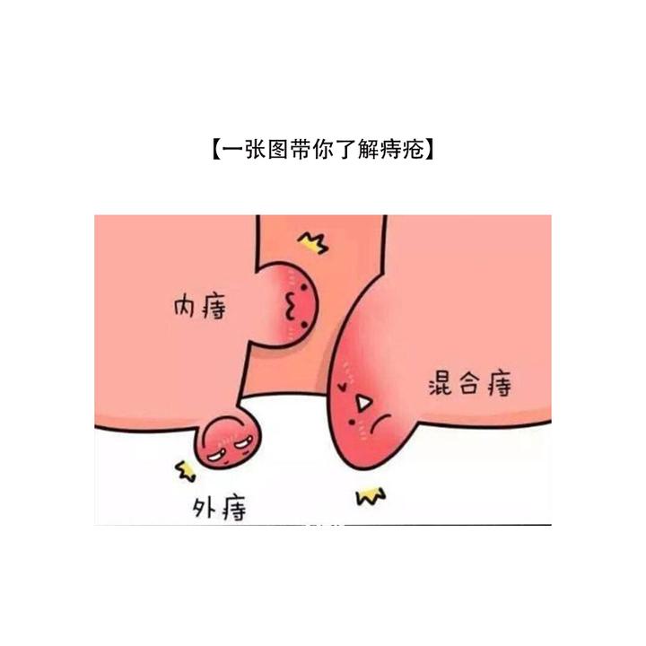 外痔小肉球到底是怎么回事?