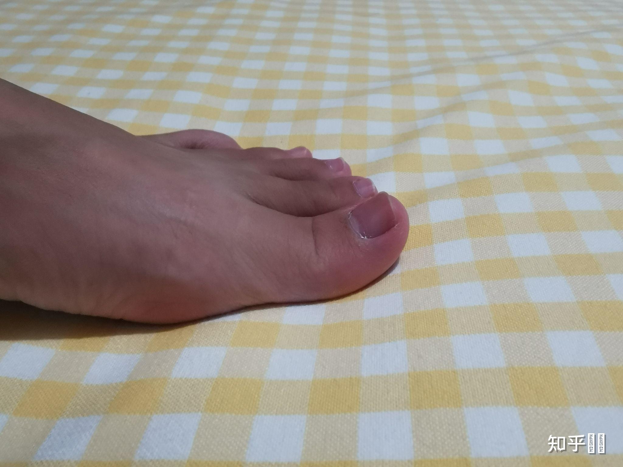 脚趾翘的人根本穿不了乐福鞋,奶奶鞋,大脚趾会被鞋面顶的非常疼