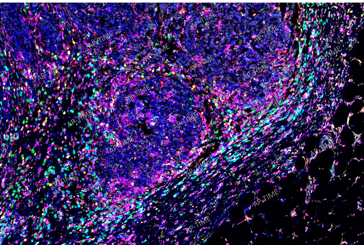 多重荧光(多色荧光)免疫组化图像分析
