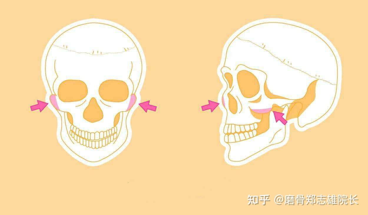 臉部兩邊超級明顯不對稱怎麼矯正