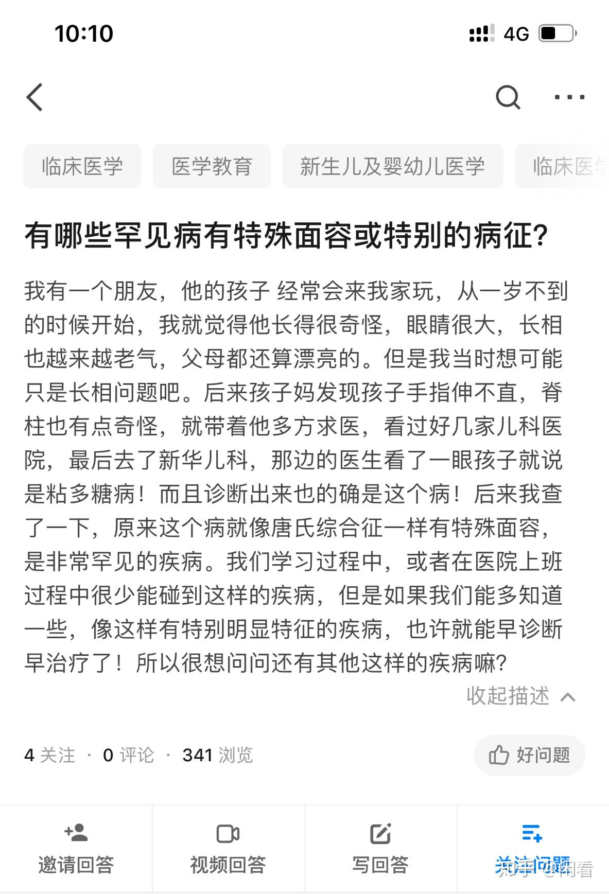 有哪些罕見病有特殊面容或特別的病徵