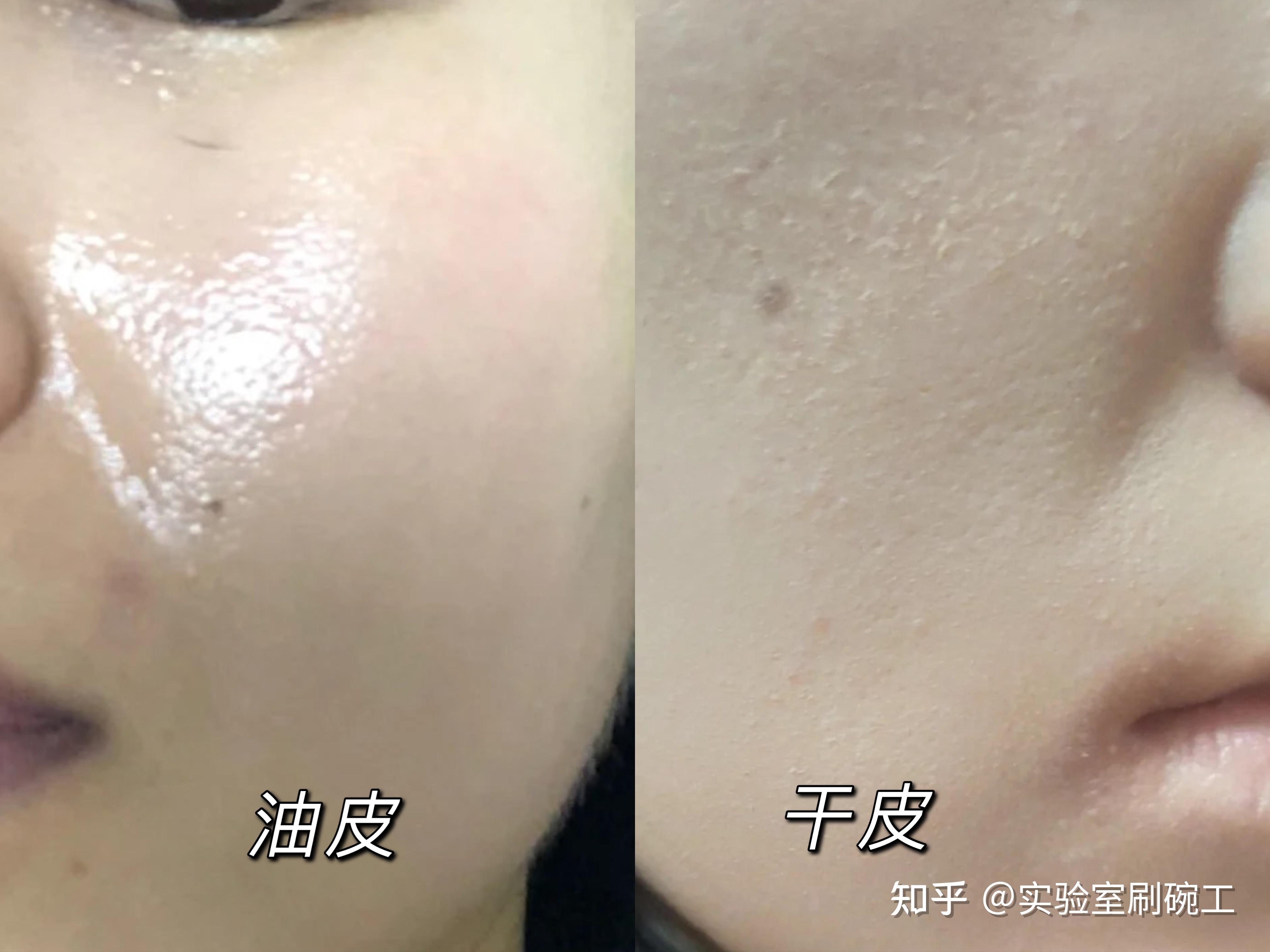 怎么辨别自己是干性皮肤还是油性皮肤