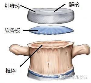 椎体终板炎 | 发生机制、分型以及 MRI 表现 - 知乎