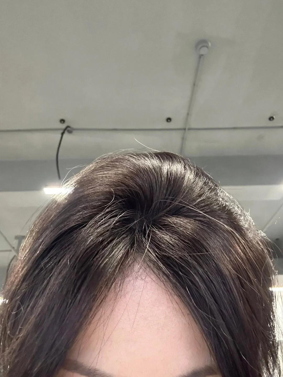 为什么维生素b6能够让头发变浓密?