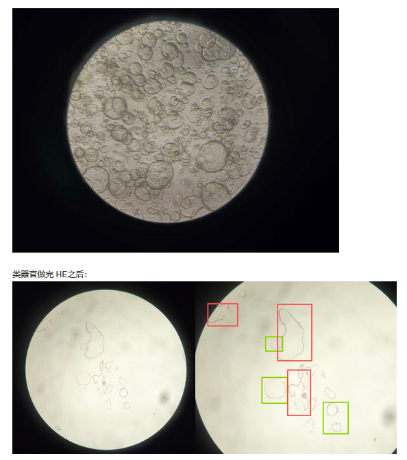空泡状类器官做完HE之后,形状不圆了? - 知乎
